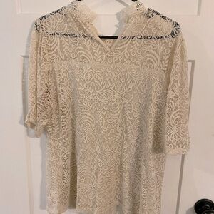 Lace Dress top